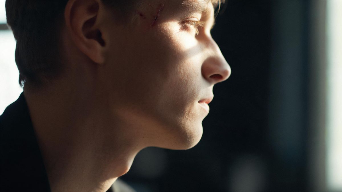 Close-up of a cheek and jaw in soft window light, a faint mark near the temple, the rest of the face out of frame